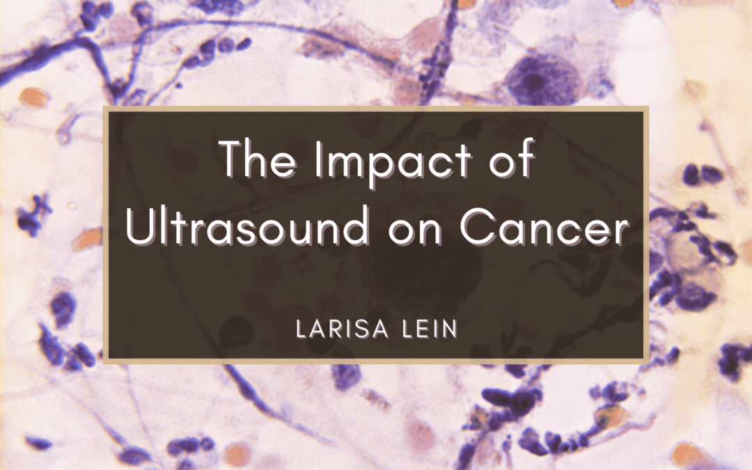 The Impact of Ultrasound on Cancer