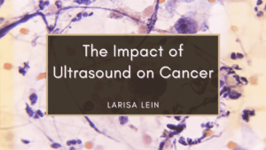 The Impact Of Ultrasound On Cancer Min