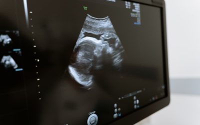 Trends in Ultrasound Technology