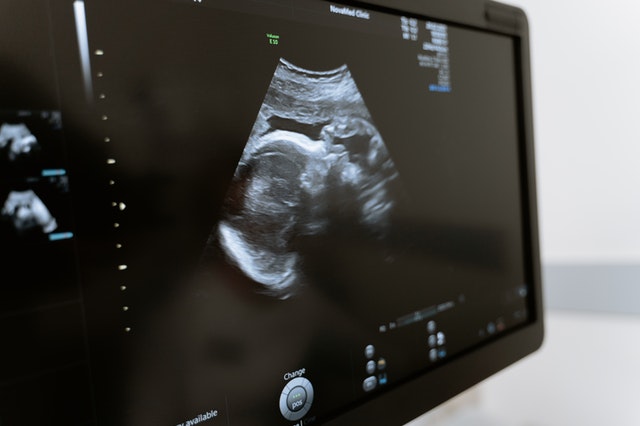 Trends in Ultrasound Technology